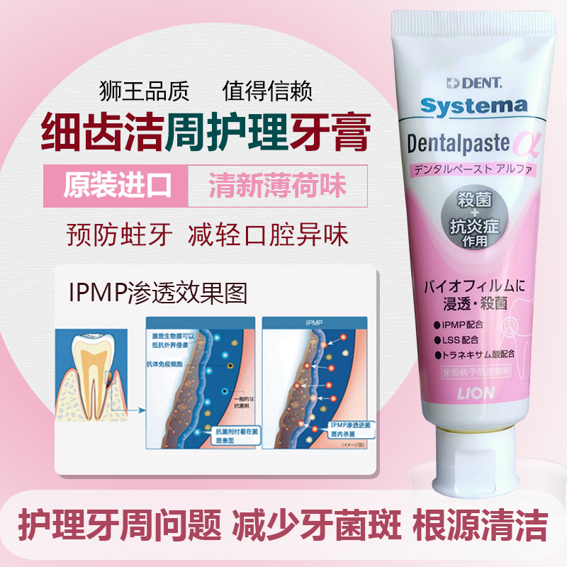 进口狮王细齿洁牙周护理牙膏90g 牙质护齿健龈清新口气减牙渍含氟