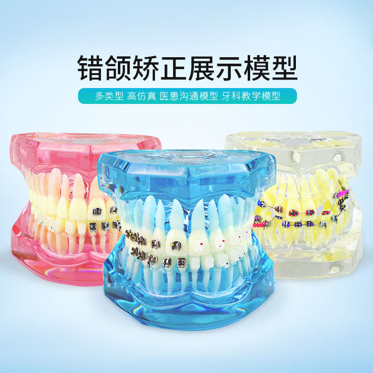 正畸模型自锁金属陶瓷