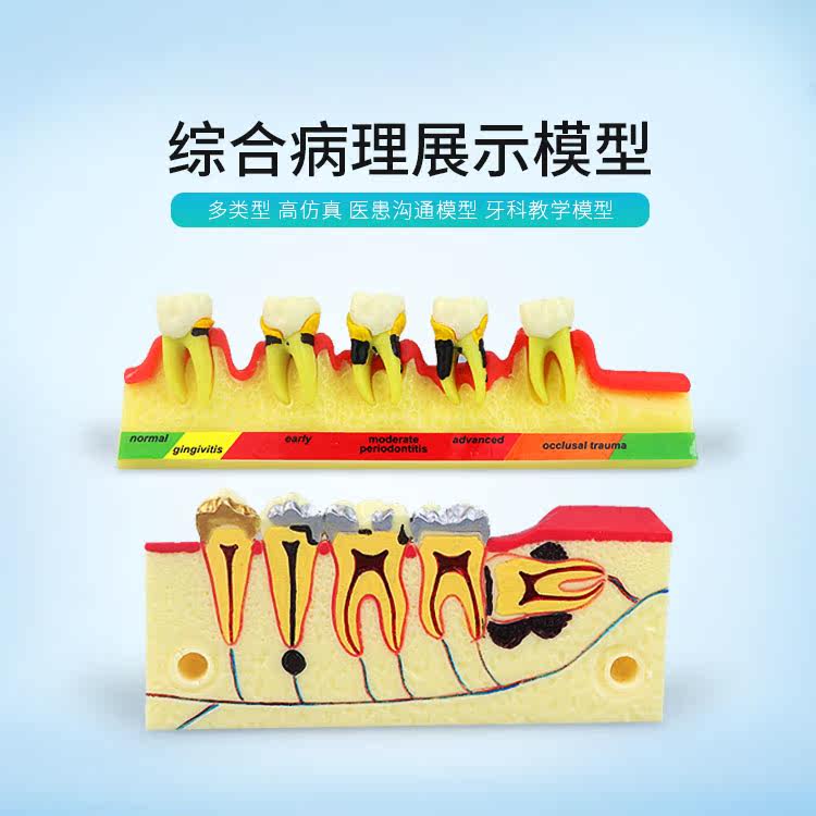 儿童种植智齿成人星星