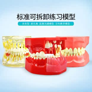标准模型拔牙儿童成人刷牙乳恒牙萌出窝洞制备牙冠雕刻剖面开髓