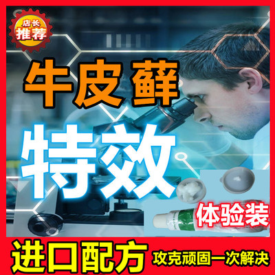 去除顽固牛皮藓銀榍病体股藓皮焱湿诊荨麻诊过敏瘙痒止痒进口软膏