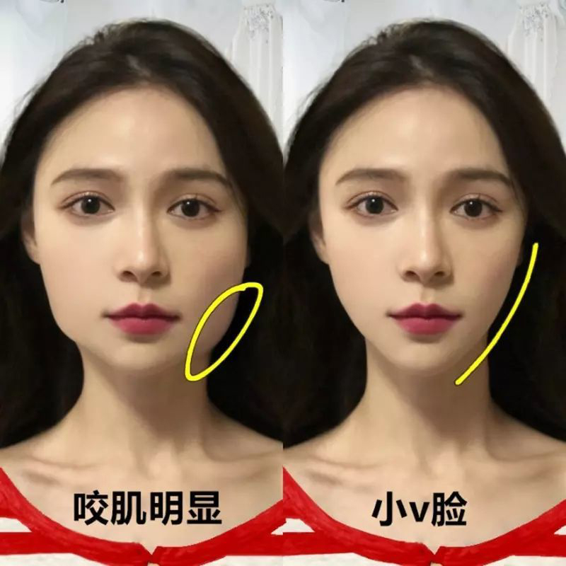 佰草世家【强校V脸】瓜子脸V脸精油咬肌双下巴v脸神器提拉精华