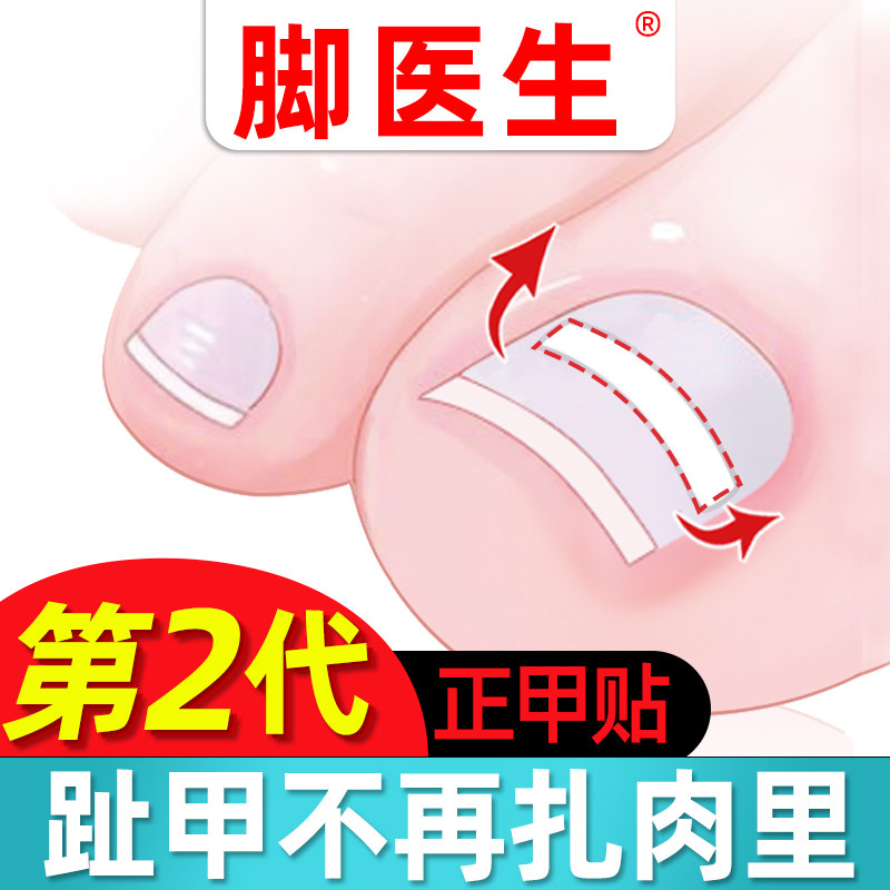 脚医生正甲贴甲沟嵌甲矫正器炎拉拉指甲长肉里趾甲贴片修脚刀套装|msdalam kategori keluarga/Alat Pembersihan peribadi, Peralatan pembersihan penjagaan diri, Gunting kuku/Gunting kuku, kuku/Manicure Set - dari Buy2taobao.com untuk memberikan perkhidmatan ejen Taobao profesional membeli