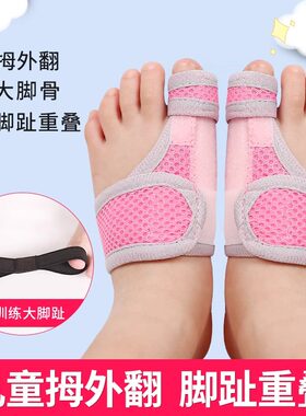 儿童大脚趾矫纠内扣正器拇指外翻