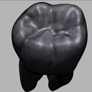 Geomagic/UG/Proe/Mimics/3D Slicer/Simpleware逆向建模型仿真