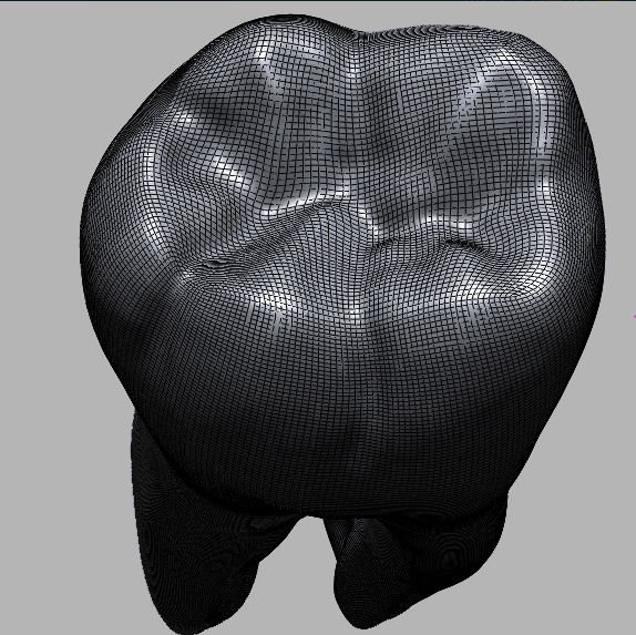 Geomagic/UG/Proe/Mimics/3D Slicer/Simpleware逆向建模型仿真
