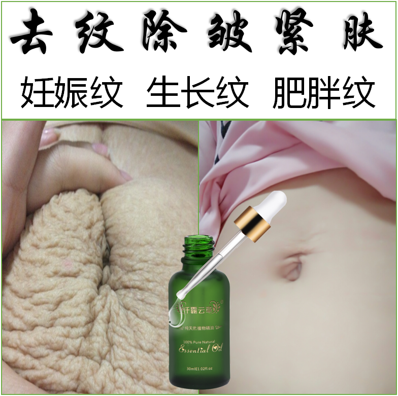 去除妊娠纹修复霜产后祛壬辰纹消除生长纹紧致肥胖纹肚子大腿产品