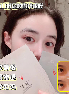 新版7000针！日本高阳社BIBALI玻尿酸微针眼膜淡化细纹干纹黑眼○