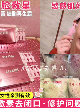 日本CRYSTAL皮肤科敏感痘痘去闭口泛红缩毛孔桃花膏面霜
