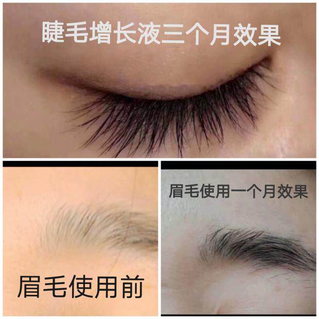 孕睫术 睫毛增长液 眉毛增长液 发际线 生发通用3ML一只