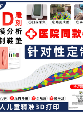 骨科3D取模定制儿童扁平足矫正鞋垫足外翻内八字XO型腿足弓垫支撑