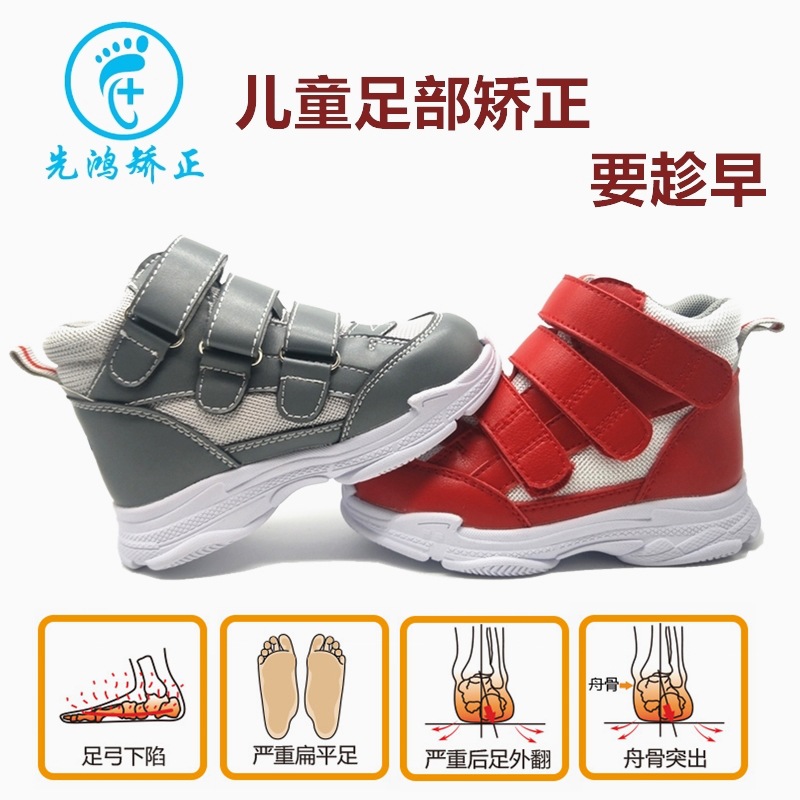 矫正鞋有用吗,须知这些知识!  第2张