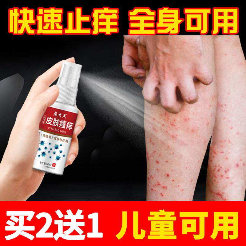 夏天皮肤干燥止痒腿痒小腿身上瘙痒全身痒外用药出汗喷雾夏季