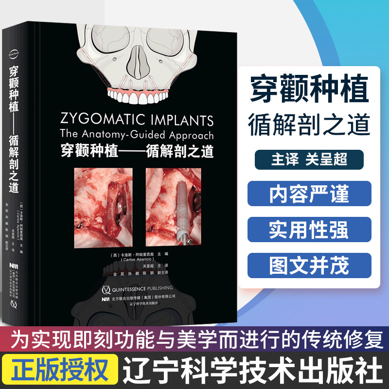 3正版 基于解剖指导的穿颧种植 循解剖之道 牙科口腔医学 卡洛斯 阿帕里西奥 主编 关呈超 主译  辽宁科学技术出版社