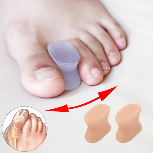 分趾器矫正脚趾重叠分离器柔软