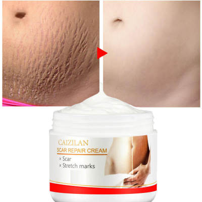 Scar Repair Cream Acne Scars Remove Pregnant Women Skin Care