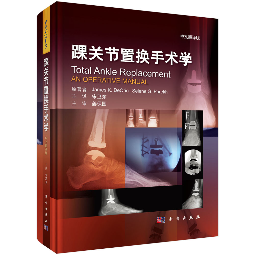 踝关节置换手术学 中文翻译版 本书描述了全踝关节置换术这一新技术的适应症 术前准备等 美 詹姆斯 德奥里奥等 著科学出版社