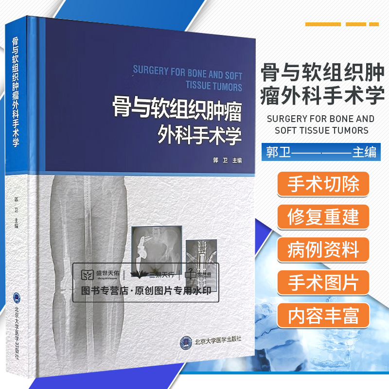 骨与软组织肿瘤外科手术学 郭卫 良性骨肿瘤的外科治疗恶性骨肿瘤的保肢治疗儿童恶性骨肿瘤的保肢治疗等 北京大学医学出版社
