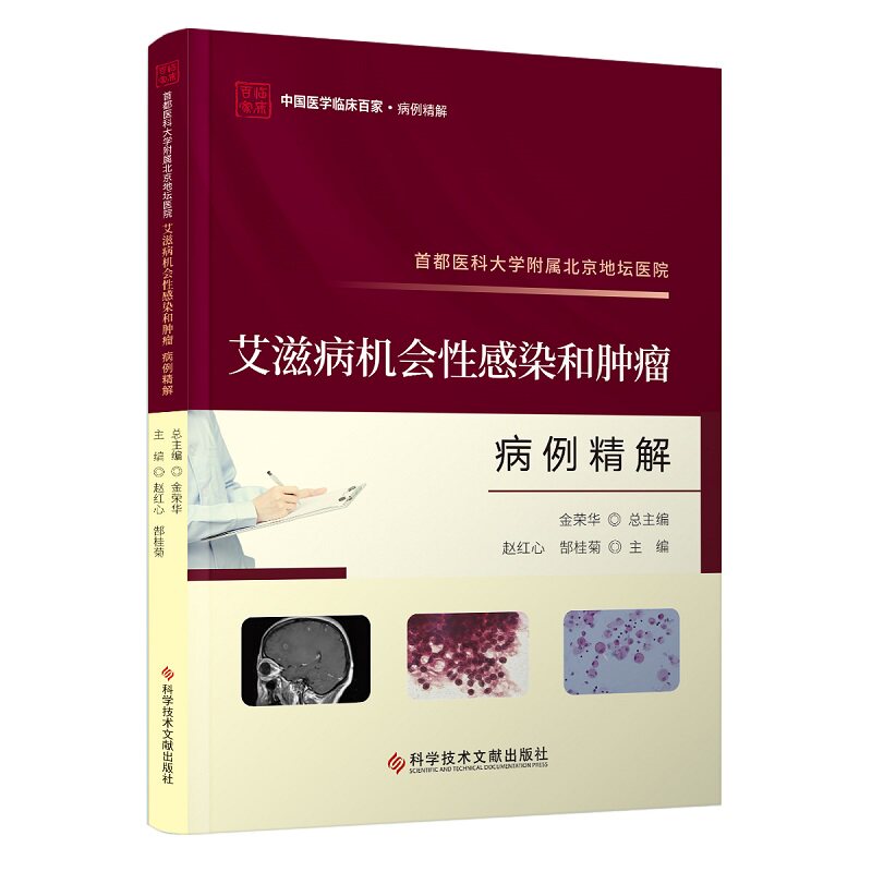 都医科大学附属北京地坛医院艾滋病机会性感染和肿瘤病例精解 赵红心 郜桂菊 主编 科学技术文献出版社 卡波西肉瘤 淋巴瘤