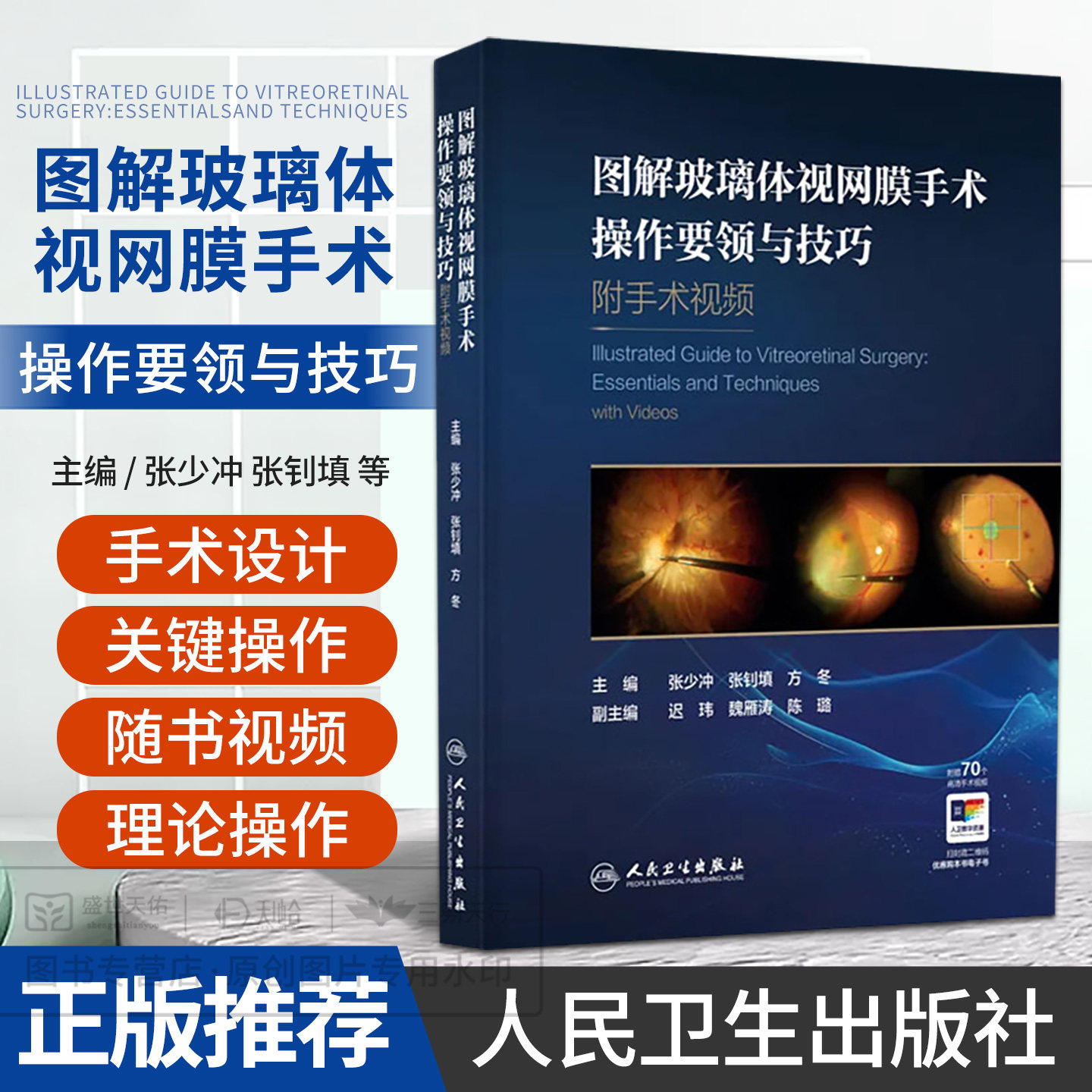 图解玻璃体视网膜手术操作要领与技巧 附手术视频 张少冲 张钊填 方冬 9787117403016 人民卫生出版社 70个高清手术视频 900+幅图