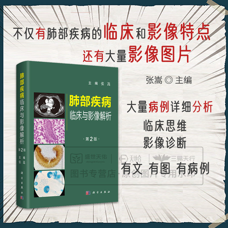 肺部疾病临床与影像解析第2二版 肺部疾病的临床和影像特点 张嵩 侧重影像的诊断和鉴别诊断 肺部肿瘤 气管支气管疾病 科学出版社