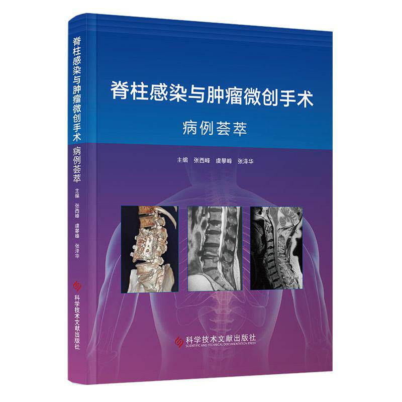 脊柱感染与肿瘤微创手术病例荟萃 张西峰 虞攀峰 张泽华 9787523522974 科学技术文献 微创手术在脊柱感染与肿瘤治疗中应用细节