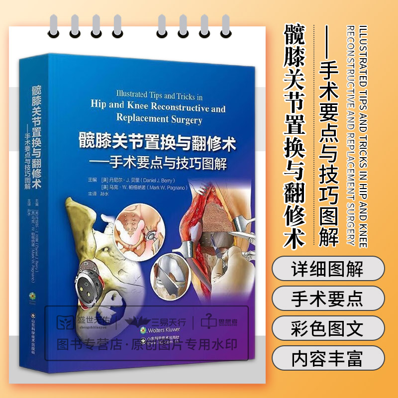 髋膝关节置与翻修术山东科学技术