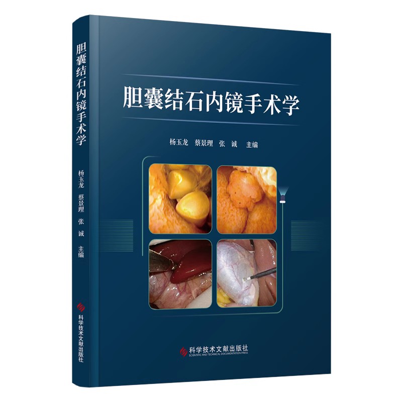 胆囊结石内镜手术学 杨玉龙 蔡景理等 胆囊相关的基础知识 各种胆囊手术基本方法特殊类型保胆手术方法等 科学技术文献出版社