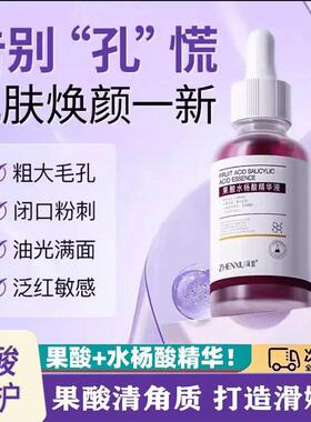 正品果酸换肤刷酸鸡皮肤手部背部身体男士高浓度毛周角化全身净肤