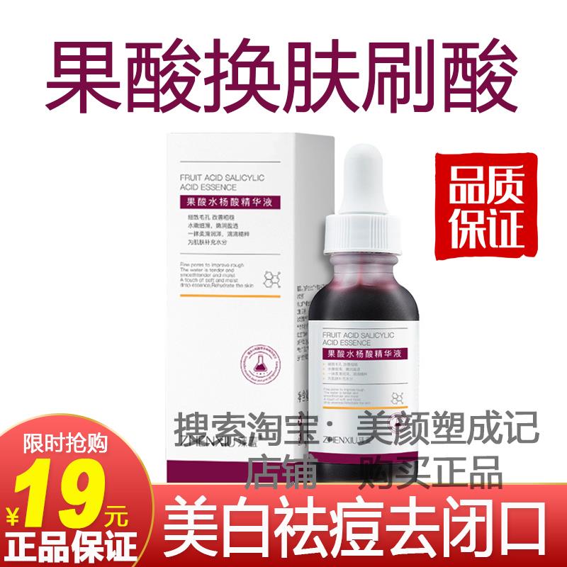 正品果酸换肤刷酸鸡皮肤祛斑手部背部身体男士高浓度毛周角化全身