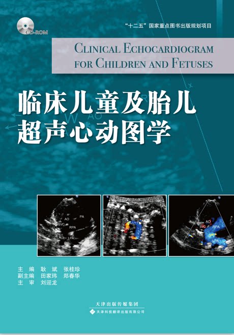 临床儿童及胎儿超声心动图学 耿斌 张桂珍主编 天津科技翻译出版社 先