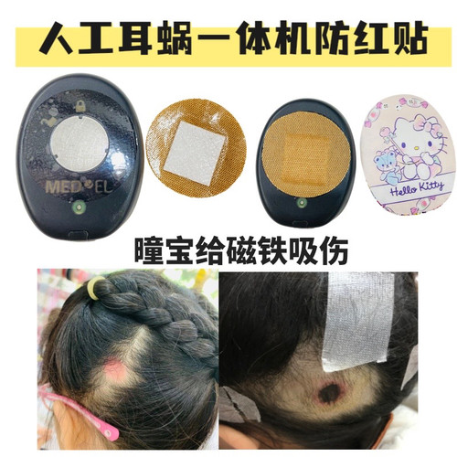 人工耳蜗一体机防汗防红贴RONDO1 RONDO2 RONDO3