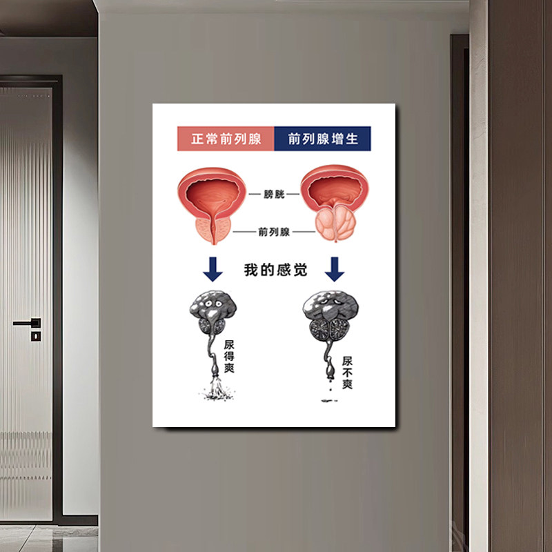高清出图优质密度板配送无痕钉