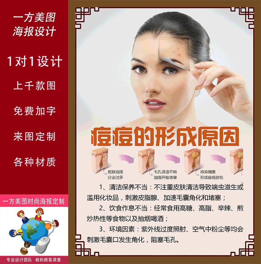 黄褐斑雀斑的形成 胎记形成分类 真皮斑形成 痘痘的形成原因海报