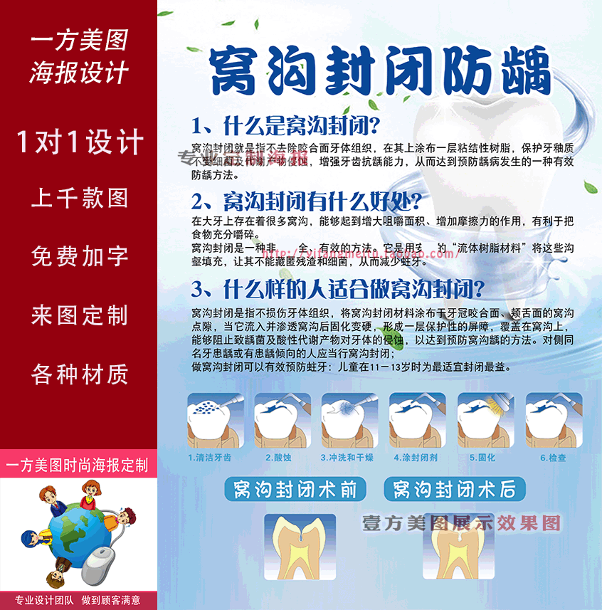 窝沟封闭防龋海报宣传画装饰画挂画广告展板口腔科护理牙科牙齿
