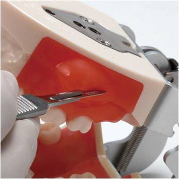 ENOVO颐诺口腔执业考脓肿切开和牙体预备模型牙槽口腔脓肿切开