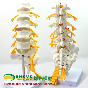 ENOVO颐诺医学人体五节腰椎模型 马尾神经坐骨神经模型脊椎骨科模