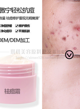 终结者oem加工傲宁清理祛痘霜