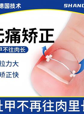甲沟嵌甲矫正器卷甲专用镍钛钢丝指甲往肉里长炎正甲贴纠正工具