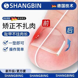 甲沟矫正神器指甲嵌甲专用隔离填充垫片脚趾甲往肉里长纠正甲贴炎