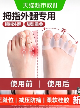 足印部落硅胶拇外翻矫正器