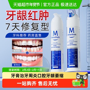 口腔红肿脱敏膏抗敏感脱敏剂护理专用含氟除牙菌斑溃疡牙周暴露
