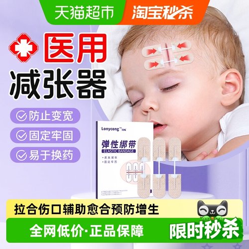 隆畅减张贴减张器医用术后减张力