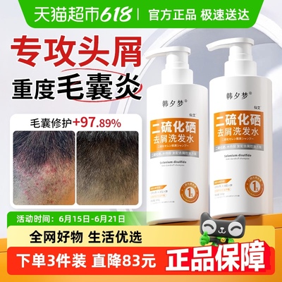 二硫化硒去屑控油洗发水