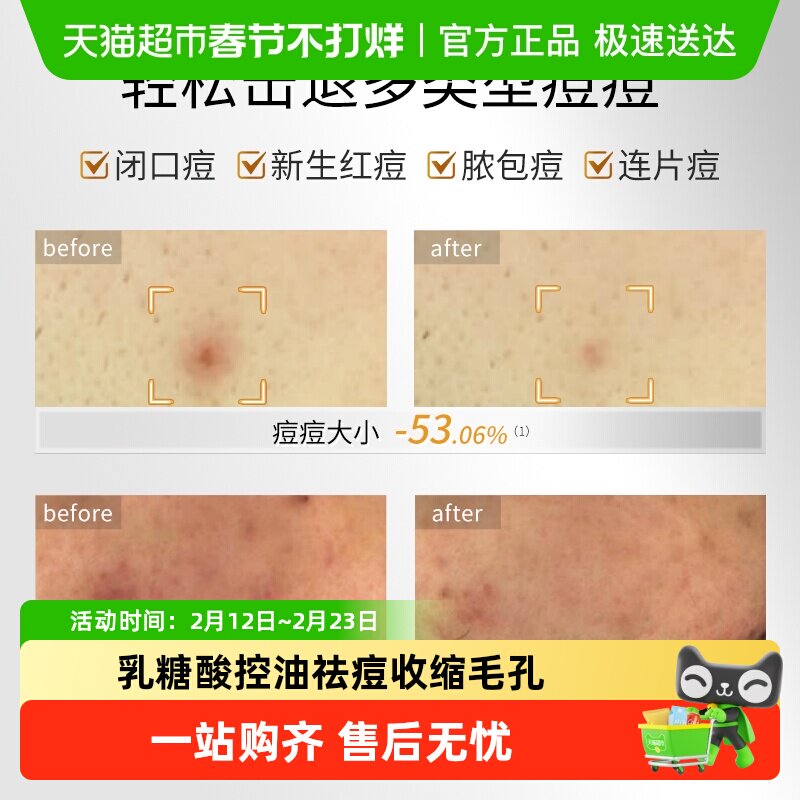 【品牌自营】敷尔佳乳糖酸控油面膜收缩毛孔祛痘补水保湿油痘肌