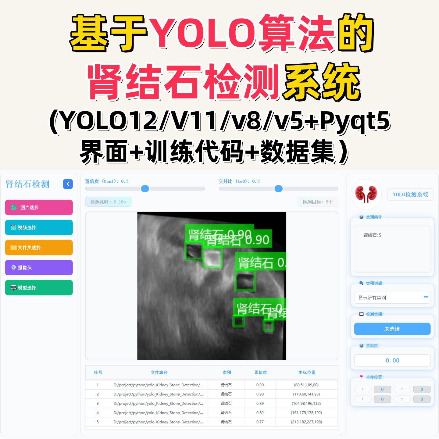 基于深度学习的肾结石检测系统(YOLOv12/v11/v8/v5模型)