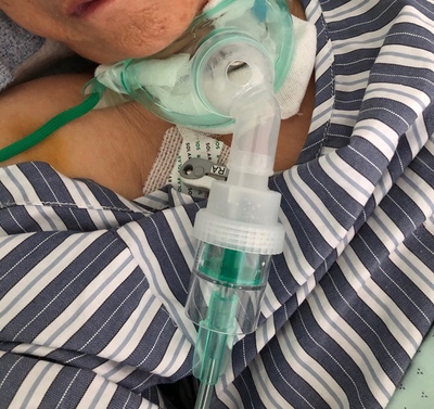 切喉人工气道用雾化器气切喉罩