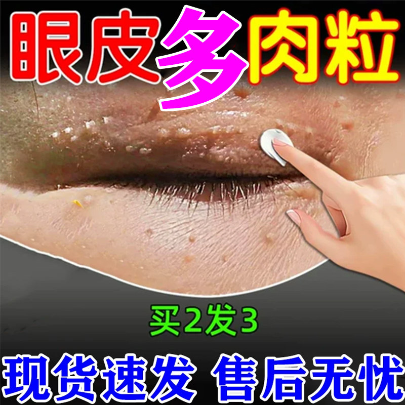 脖子脸部眼周眼皮长小肉粒