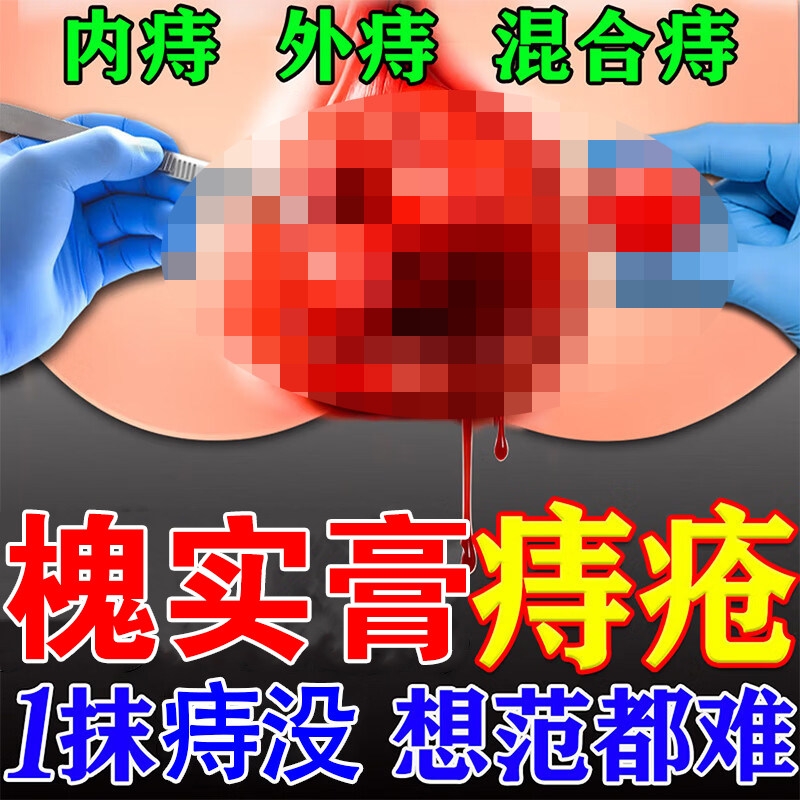 槐实膏痔疮倪海厦枯痔散无花果叶子非中药偏方膏痔断疮根正品