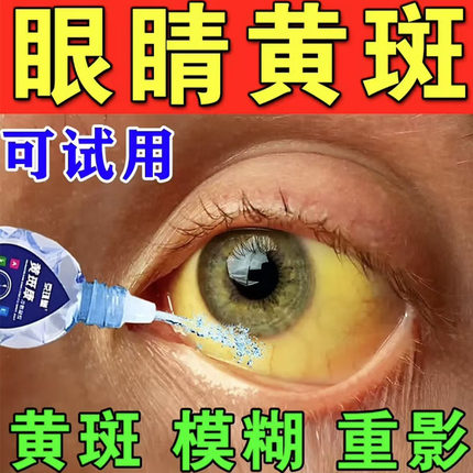 眼白发黄眼睛清澈去黄红血丝浑浊修复眼睑眼底黄斑病变滴眼液药水
